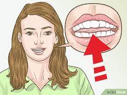 Helping a lisp one common speech impediment seen in children and young adults is a lisp, specifically when reciting the letter s. 4 Ways To Cope With Having A Lisp Wikihow
