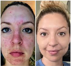 Monat with Katie Cetina