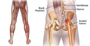 The muscles of the back can be divided in three main groups acc. 7 Poses To Soothe Sciatica