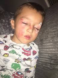 Parent's horror as Freddie, 5, left in pool of blood after cyclist knocks  him off bike