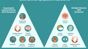 Als is a progressive disease, which means it gets worse over time. Als And Multiple Sclerosis Similarities And Differences
