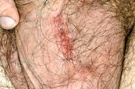 Image result for Scrotum