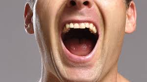 نتیجه جستجوی لغت [pulling] در گوگل