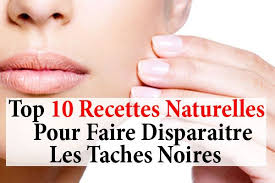 Comment Faire Disparaitre Les Taches Noires Sur Le Visage La Beaute Naturelle Taches Noires Sur Le Visage Taches Noires Tache Visage