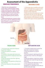 9 Tips For Performing A Nursing Health Assessment On The Gastrointestinal System Medical Surgical Nursing Assessment Surgical Nursing