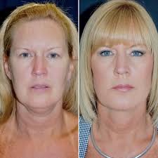 Obi Plastic Surgery Clinic