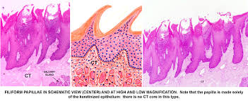 Image result for Filiform Papillae