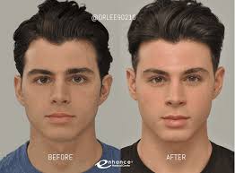 Look Your Best from Cheek to Cheek