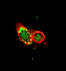 Das kommt ganz auf das antibiotikum, auf das bakterium und die erkrankung an. Menschliches Antibiotikum Wirkt Wie Ein Detergens Wissenschaft Aktuell