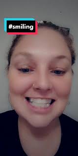 Journey to a Perfect Smile with Aligners