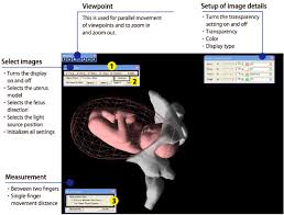 It involves a doctor or midwife rubbing their fingers against the membranes of the amniotic sac to release prostaglandin into the uterus and. Virtual Reality Vaginal Exam Model Lm 095 Koken Co Ltd