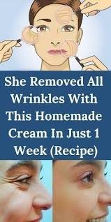 She Removed All Wrinkles With This Homemade Cream In Just 1 Week Recipe In 2020 Face Wrinkles Beauty Hacks That Actually Work Wrinkles
