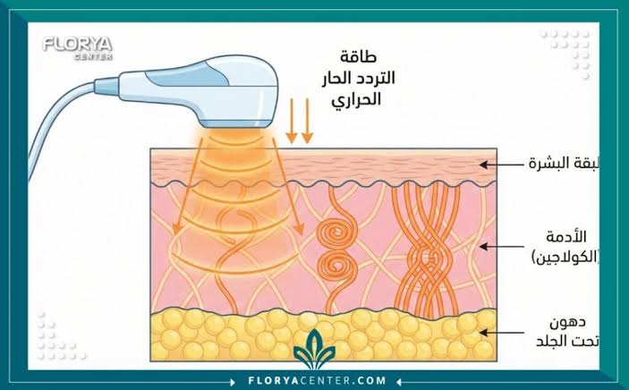 آلية عمل التردد الحراري، من إنشاء الذكاء الاصطناعي