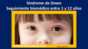 Sindrome De Down Seguimiento Entre 1 Y 12 Anos Carlosorellanaayala