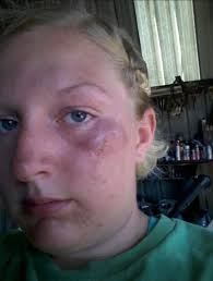 Me! One time I hit so hard it actually knocked the wind out of me I had to  go to the school nurse boohoo 😂😜🥴😂