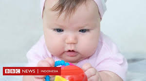 6 tahap tumbuh kembang bayi umur 1 bulan yang harus mama tahu. Penelitian Ungkap Gejala Autisme Sejak Bayi Bbc News Indonesia