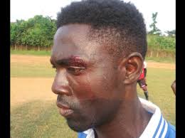 I saw the bodies of Castro and Janet