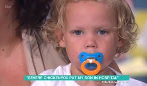 Tot with the 'worst chicken pox ever' steals the show