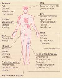 Nevertheless there are larger numbers of patients with symptoms/signs of renal disease who will require assessment and/or medical supervision at district. Chronic Renal Failure Assignment Help Homework Help