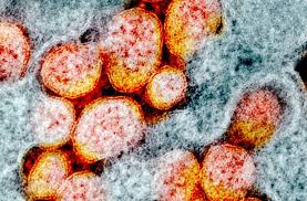 Namun kali ini admin akan mengupas habis sampai. What We Do And Do Not Know About Covid 19 S Infectious Dose And Viral Load Discover Magazine