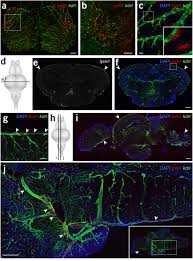 Maybe you would like to learn more about one of these? Mural Lymphatic Endothelial Cells Regulate Meningeal Angiogenesis In The Zebrafish Nature Neuroscience
