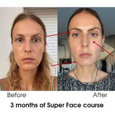 Would you just look at these results? 😱 In just 3 months, my student  managed to bid farewell to upper eyelid ptosis through face exercises. And  that's not all
