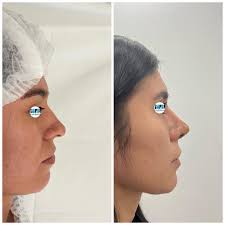 Dr. Jesús Flores Landeros‎