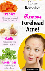 Home Remedies To Remove Forehead Acne Forehead Acne Skin Care Acne Best Acne Remedies