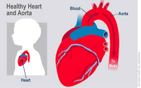 Some children may have to wait until they are physically bigger before having a heart defect repaired. Coarctation Of The Aorta For Parents Nemours Kidshealth