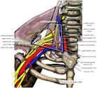 Thoracic outlet syndrome - Wikipedia