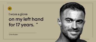 What Is it Like to Live With a Prosthetic Arm?