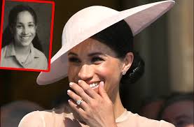 Meghan markle's engagement to prince harry spurs plastic surgery requests for the. Meghan Markle Royal Newlywed S Plastic Surgery Secrets