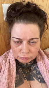 You can be happy, hurting, and healing, all at the same time."  @ngrefflevespply