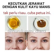 Jerawat bukan hanya pada anak remaja sahaja. Petuarawatjerawat Instagram Posts Photos And Videos Picuki Com