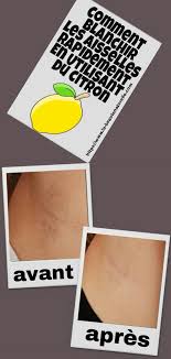 Comment Blanchir Les Aisselles Rapidement En Utilisant Du Citron Blanchir Aisselles Citron Beauty Health Beauty Tablet