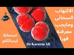 ١١٥ الالتهاب السحائي مايجب معرفته فورا لحماية اطفالك حلقة خاصه الاعراض والوقاية Youtube