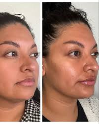 Evergreen Aesthetics