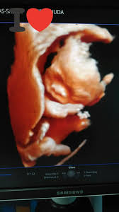 Dr.azfar bin hussin & dr.rosmaliza kamaruddin. As Salam Terima Kasih Klinik As Salam Bandar Siber Ipoh Facebook