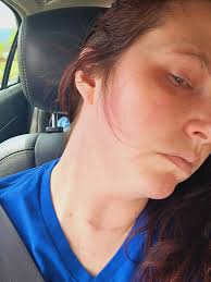 Natural Remedies for Various Health Conditions