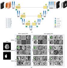 We did not find results for: Cmm Net Contextual Multi Scale Multi Level Network For Efficient Biomedical Image Segmentation Scientific Reports