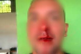 En San Gil: Entrenador de fútbol de categoría sub 17 le partió la nariz a  un árbitro