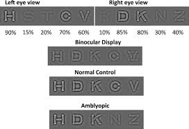 schematic diagram of the dichoptic eye chart letters were