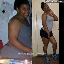 Pin On Before And After Weight Loss Stories