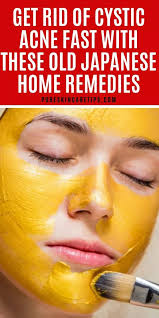 Get Rid Of Cystic Acne Fast With These Old Japanese Home Remedies Zystische Akne Akne Hautpflege