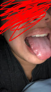Maybe you would like to learn more about one of these? Is There A Reason Why My Tongue Is Like This It Has Ridges I Think It S Because My Mouth Is Too Small But I M Not Entirely Sure Medical