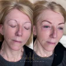 Love the natural look! Your brows and lips look amazing with zero filler,  and it's great that you've maintained a fuller and more colorful  appearance.♥️