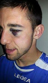 Zašto se zavaravamo da naš klupski nogomet napreduje?