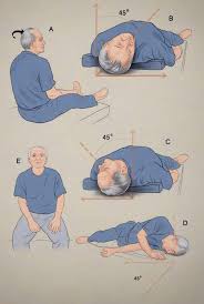 Image result for Canalith Repositioning Procedure
