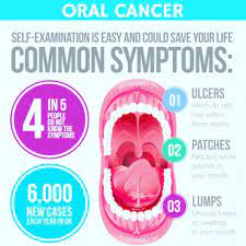 A symptom, such as pain or fatigue, is felt or noticed by the person who has it. Diy Guide For Checking For Mouth Or Oral Cancer Thailand Medical News