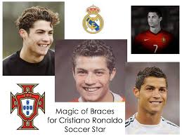 Others being a son and two daughters. Smile Makeover 1 Cristiano Ronaldo Mint Dental